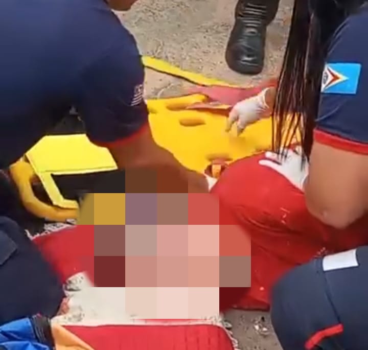 Homem fica gravemente ferido após portão do barracão fechar nele